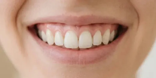 Procedimento: Correção do sorriso gengival